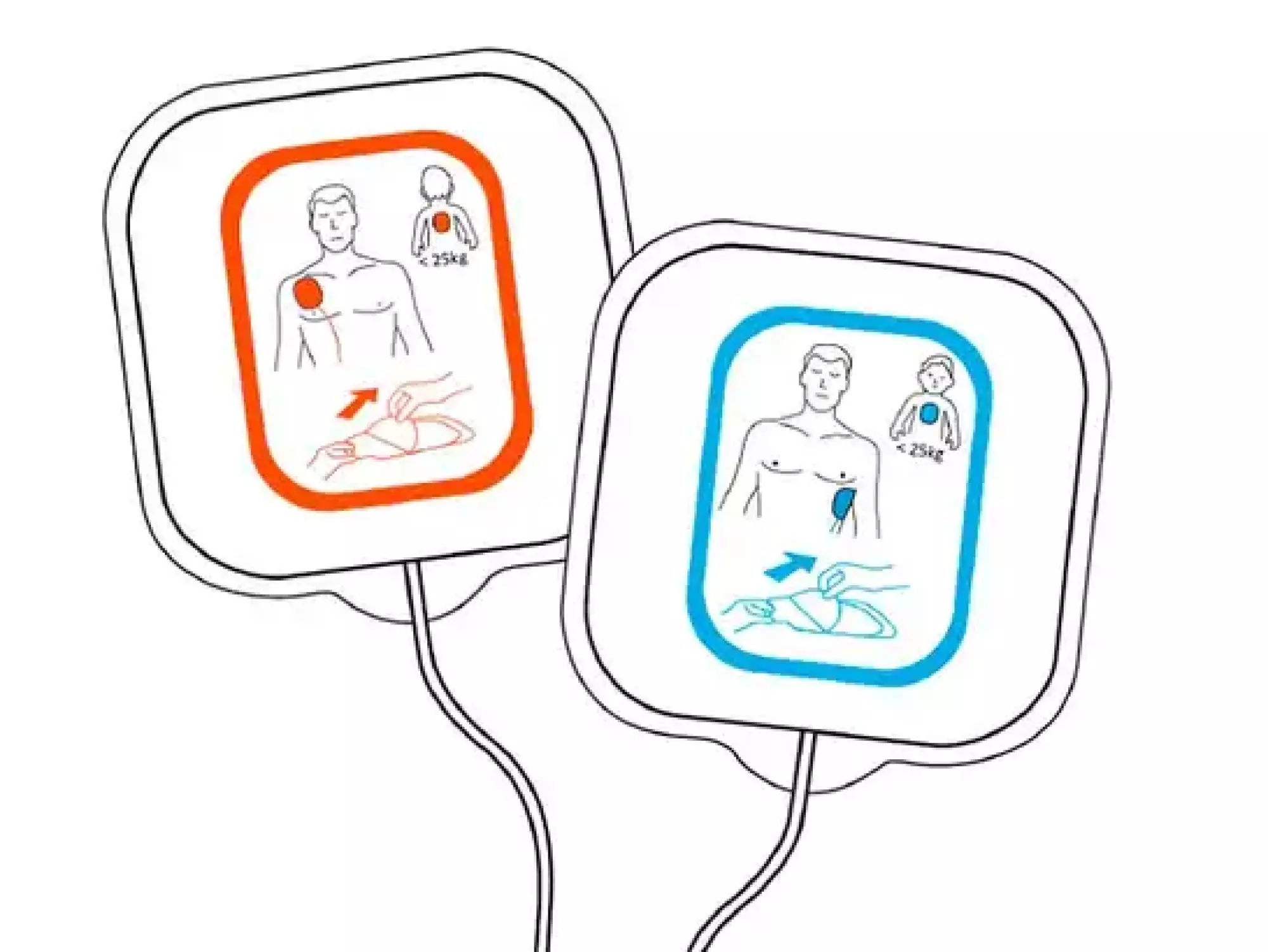 Reanibex 100 Electrodes